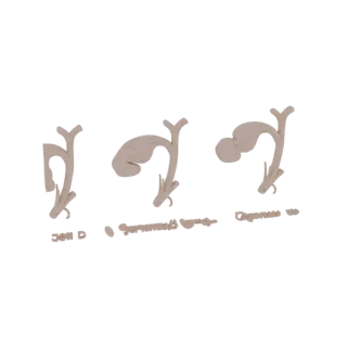 3D model of the human gallbladder, showing its shape and ductal connections, rendered in a neutral beige tone.