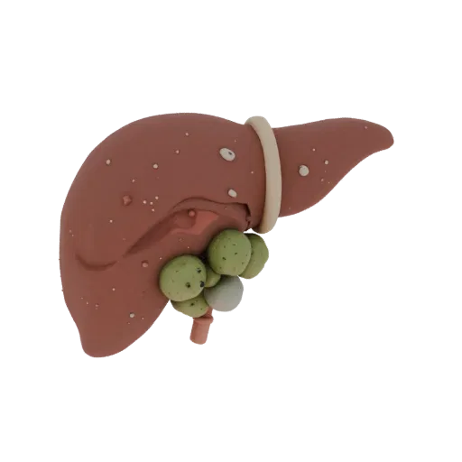 3D model of the liver with a gallbladder containing stones and bile ducts, on a white background.