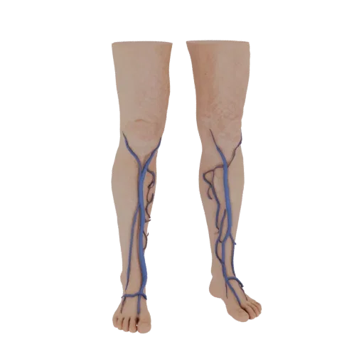 Modelo 3D de pernas femininas com varizes pronunciadas, veias azul-arroxeadas visíveis nas panturrilhas e canelas.