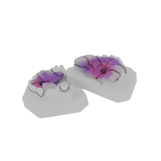 Render de modelo 3D de dos retenedores dentales con diseños florales morados y rosas y acentos de alambre negro, presentados